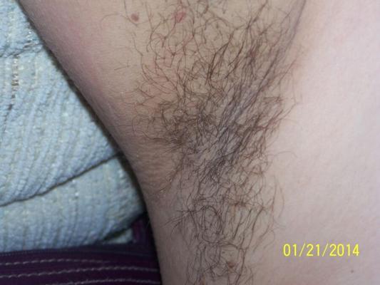 hairy pits