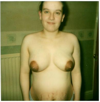 lactating breasts