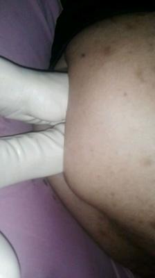 my husbands huge hole