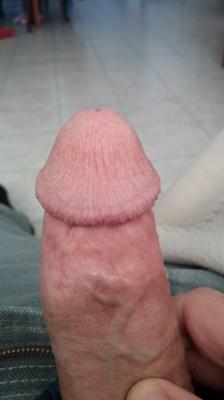 mi pene