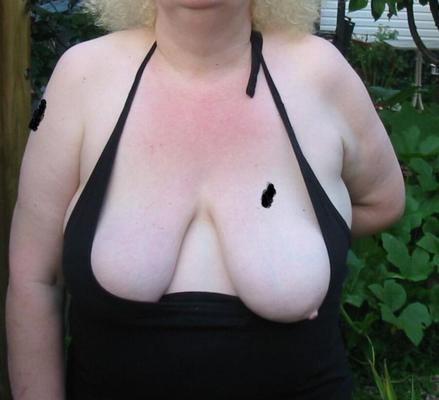 Frau Nipslip BBW