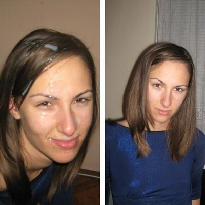 Facial Antes e Depois