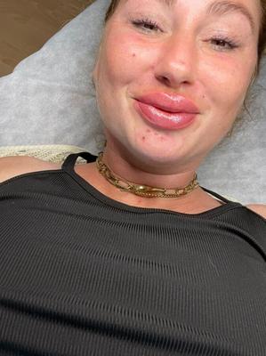 Jasmins neue Blowjob-Lippen