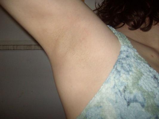 My prickly little armpits.