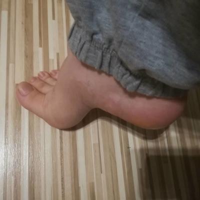 Mis pies de hombre y a mí también me encantan.