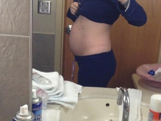 Postpartum belly