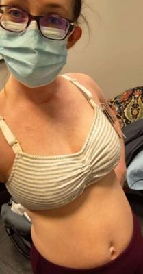 Unaware Married Nurse Private Photos Posted Online