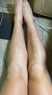 Hairy Legs LVI